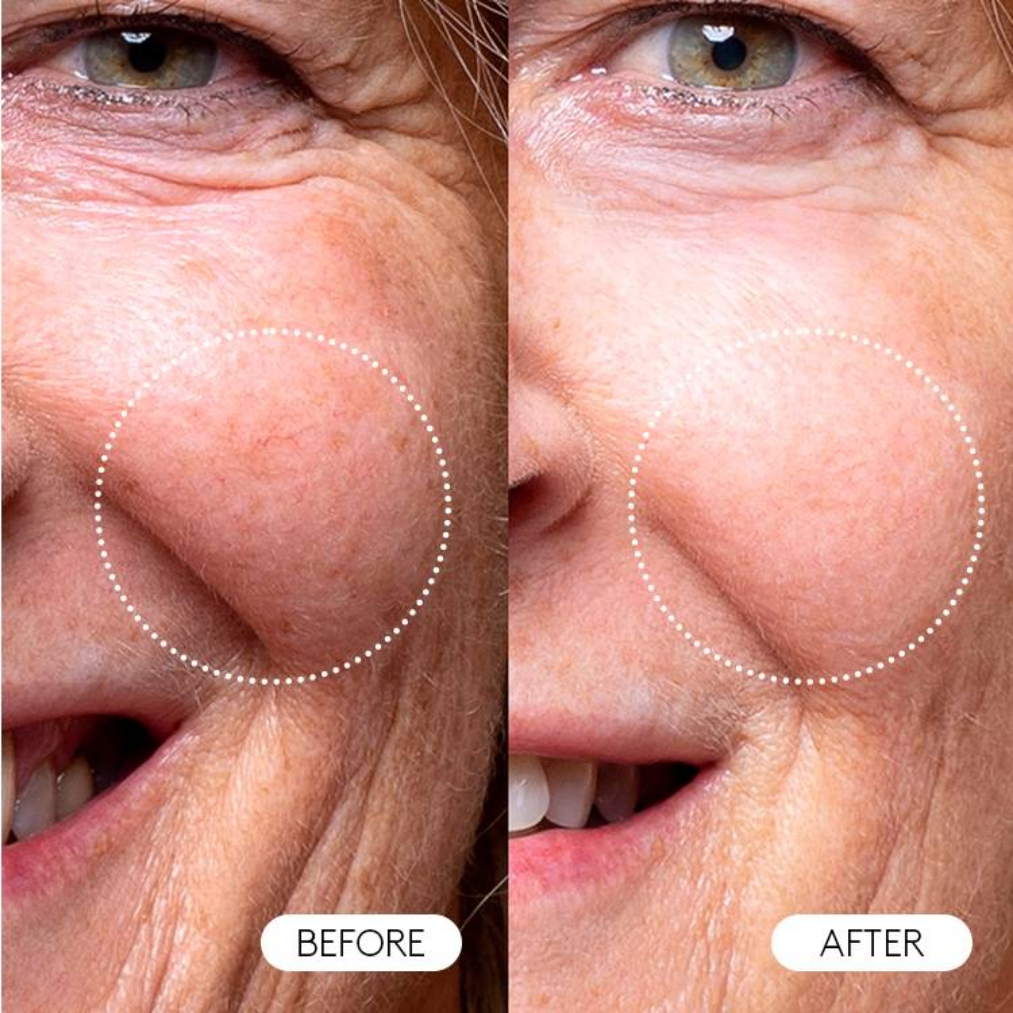 Serum Vitamina C Boots Colágeno 30ml | Luminosidad | AmaiSkin Uruguay