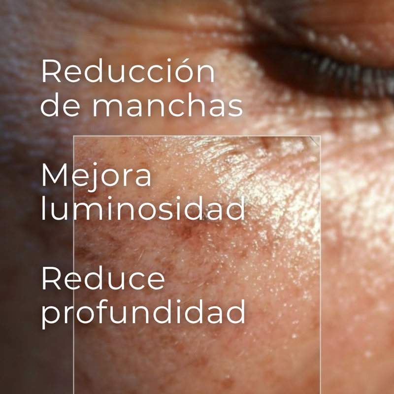 Resultados clínicos comprobados