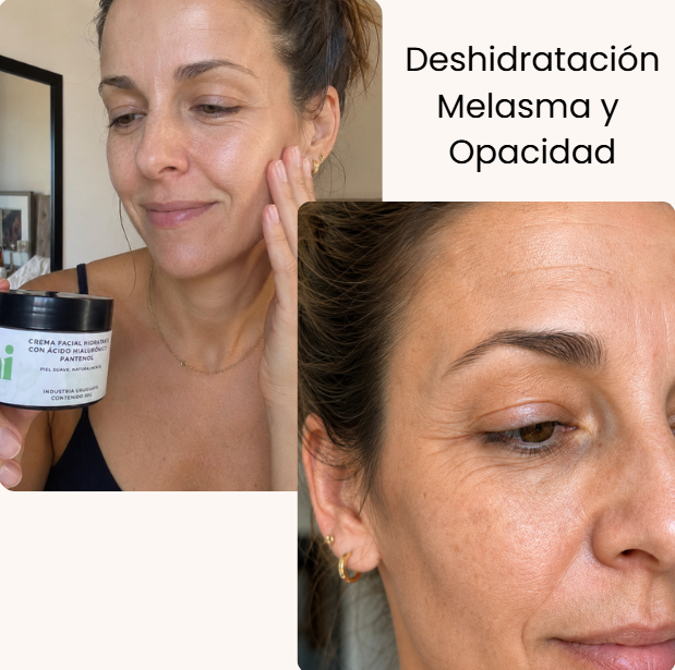 AmaiSkin™ | Relleno de arrugas, brillo, luminosidad y colágeno naturalmente