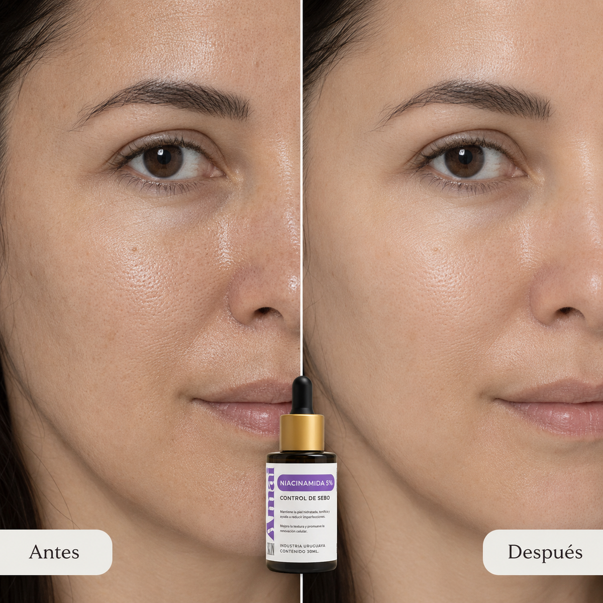 Serum control sebo Niacinamida 5%