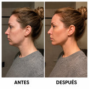Masajeador EMS Amai™ + Serum Anti edad AHA