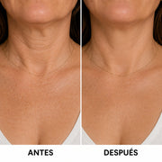 Masajeador EMS Amai™ + Serum Anti edad AHA