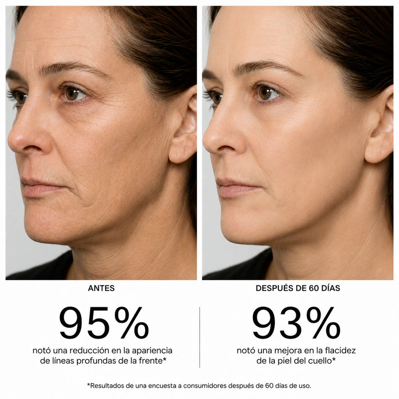 Masajeador EMS Amai™ + Serum Anti edad AHA